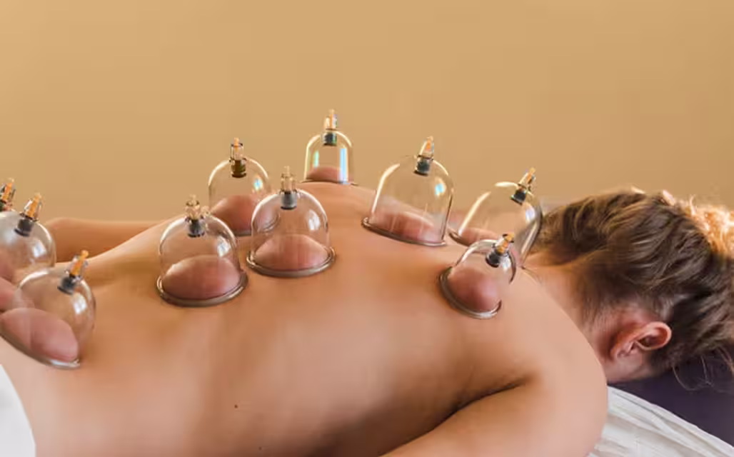 Cupping therapy treatment for wellness and relaxation